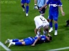 Травмы спортсмена Травмы спортсмена